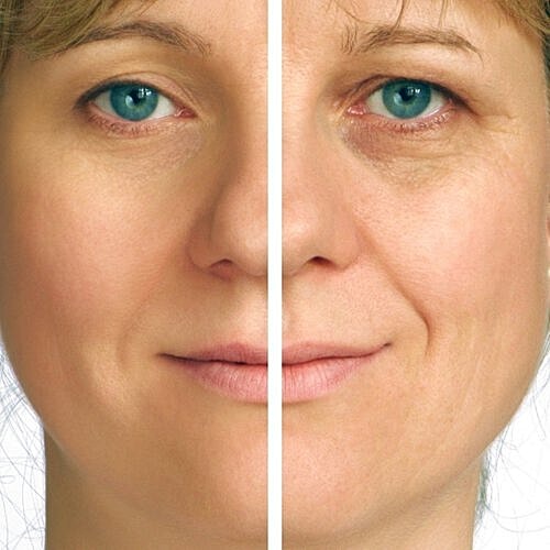Woman admiring her refreshed look after a facelift