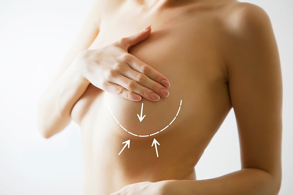 Woman reviewing common breast augmentation myths