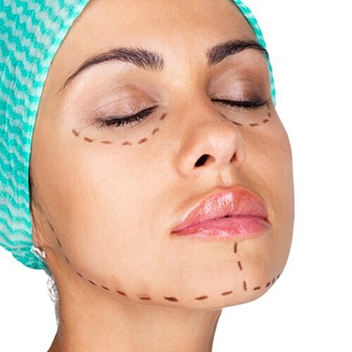 Cosmetic procedures can be a daunting territory to explore, but with the correct information, you will be set for the best results!