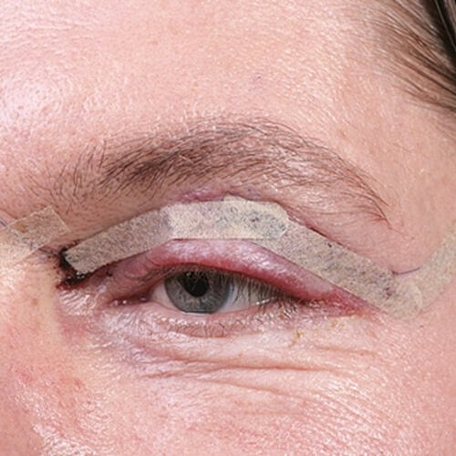 For years plastic surgery was a taboo for the male population, but more and more, older men are considering cosmetic work.