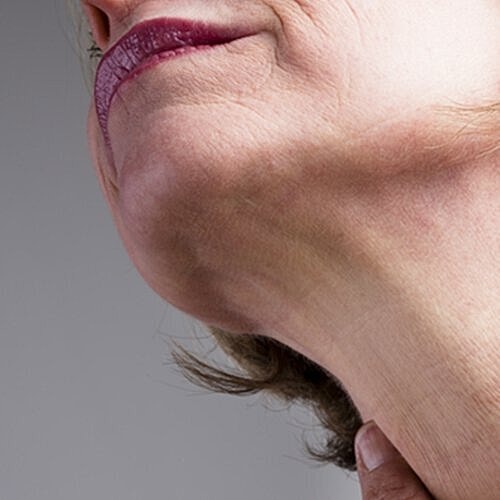 Woman touching smooth neckline after surgery.