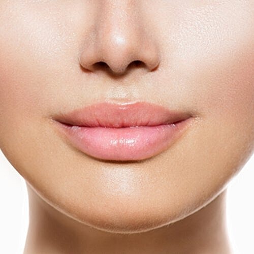 Closeup of volumized lips after subtle filler treatment.