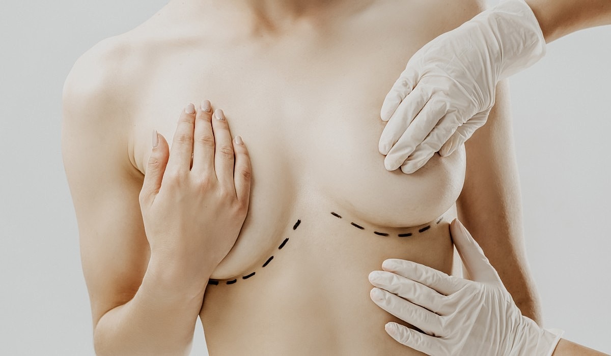 A Guide to Breast Surgery Incision Types | FORM Face + Body Toronto Plastic Surgery, Med Spa & Hair Transplant