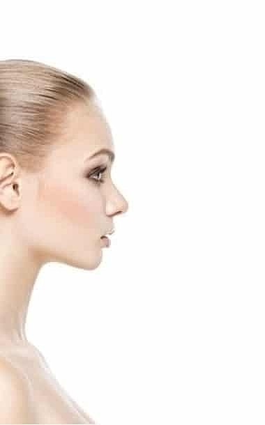 A lift without surgery? It’s possible with NovaThreads