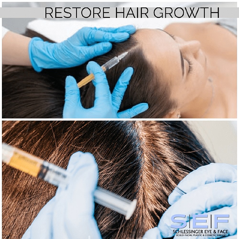 Advanced PRP (Platelet Rich Plasma) Treatments at SEF! - Image 2