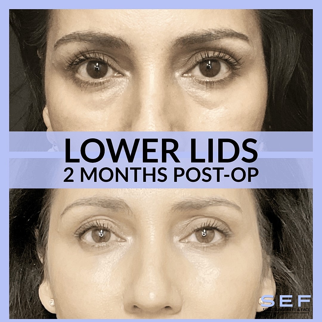 Trends in Cosmetic Facial Surgery - Image 3