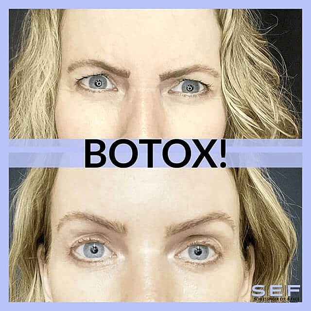 Trends in Cosmetic Facial Surgery