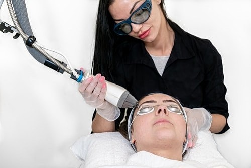 Will a Laser Peel Make Me Look Younger?