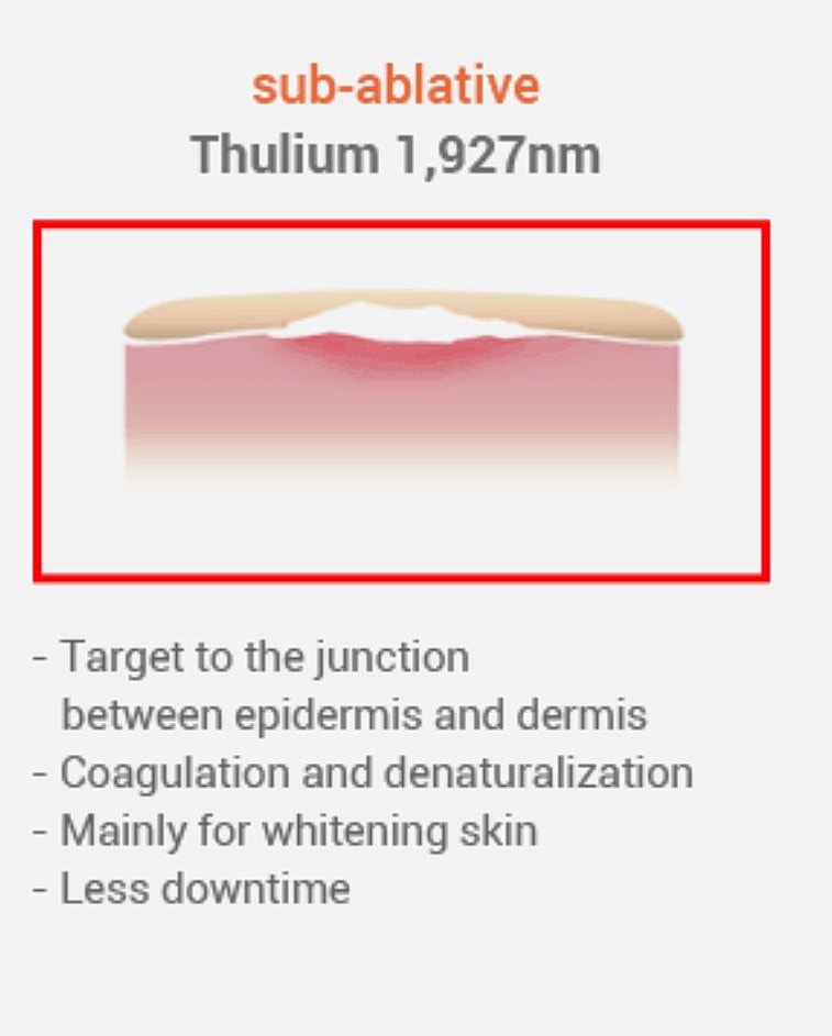 Diagram of thulium Laser resurfacing