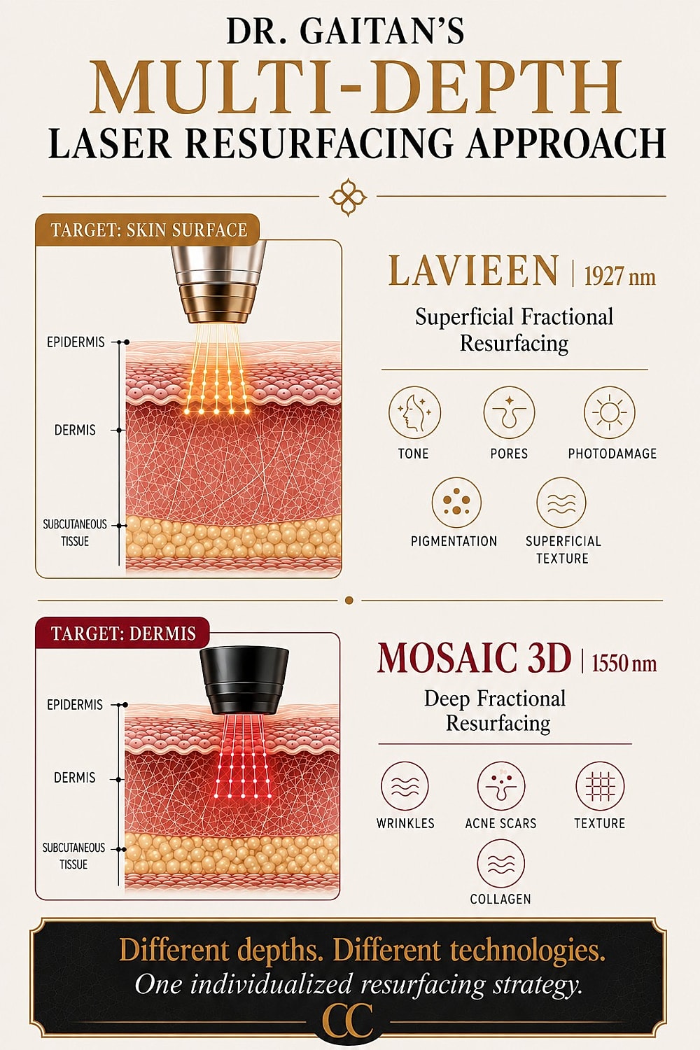 Dr. Sergio Gaitan multi-depth laser resurfacing diagram showing Lavieen for superficial skin and Mosaic 3D for deeper collagen remodeling