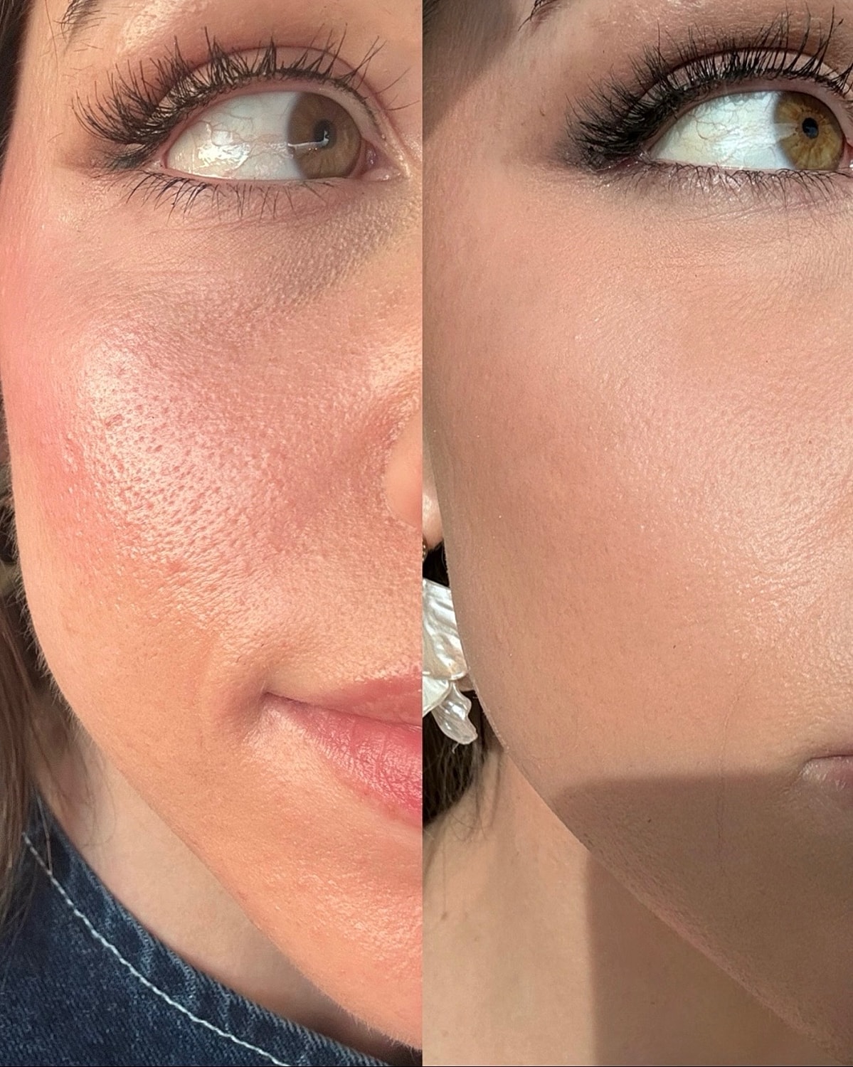 Comparison of skin texture before and after treatment.