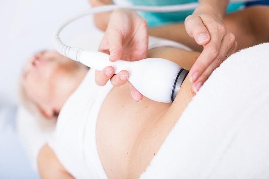 CoolSculpting applicator placed on lower abdomen