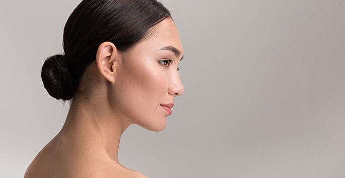 Woman with defined jawline after Kybella treatment