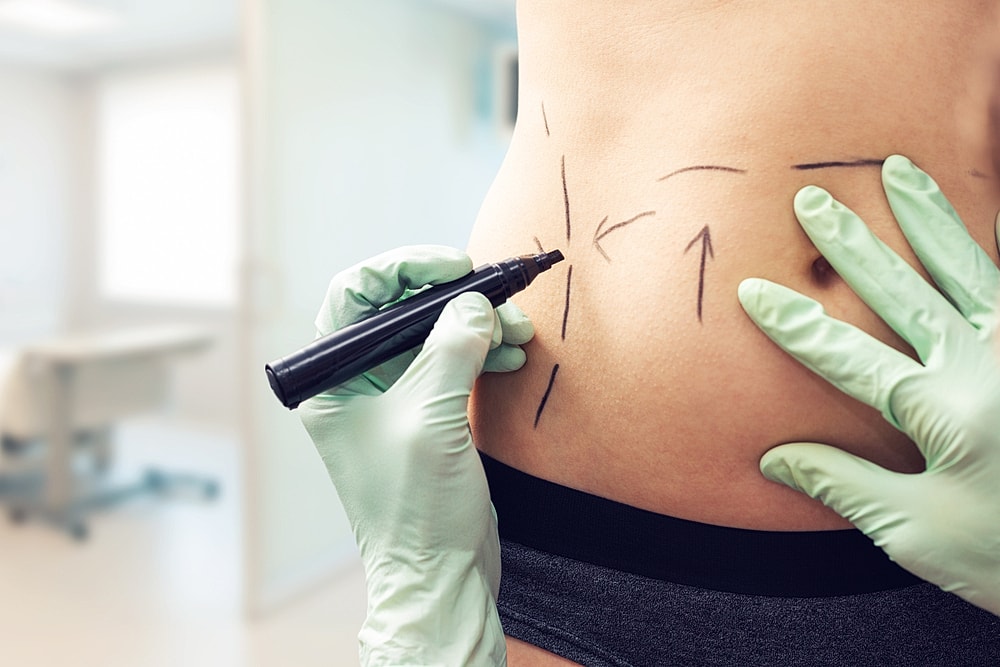 patient receiving non-surgical body contouring treatment