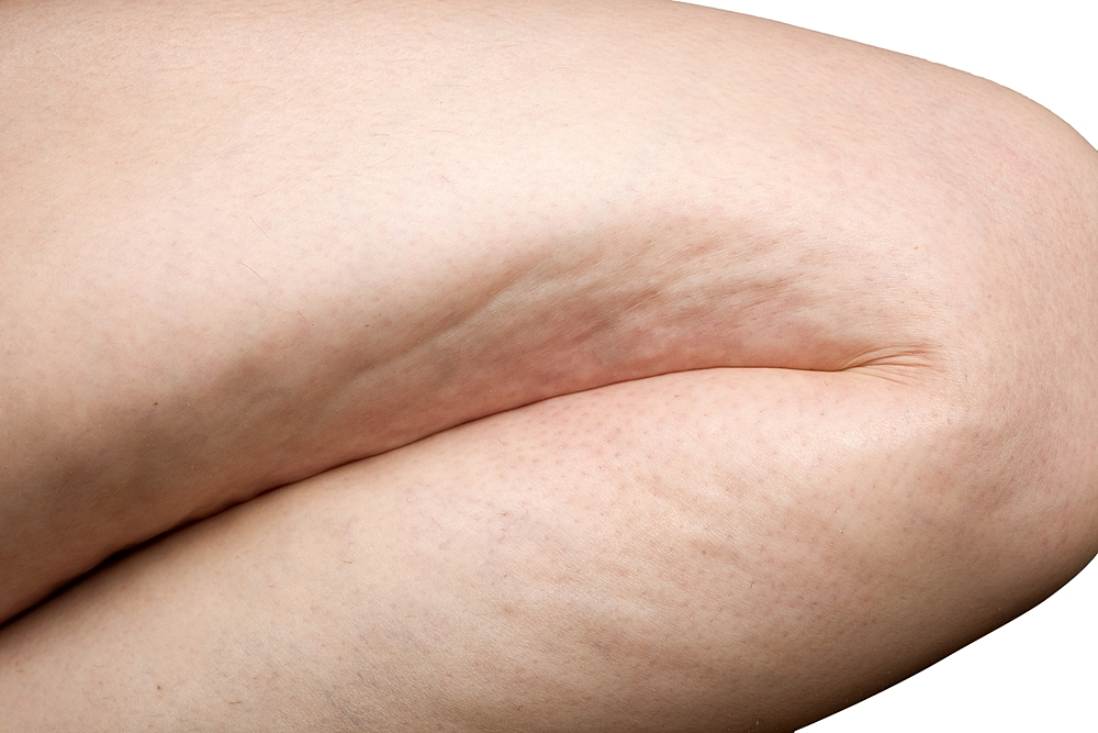 provider applying z wave device to thigh