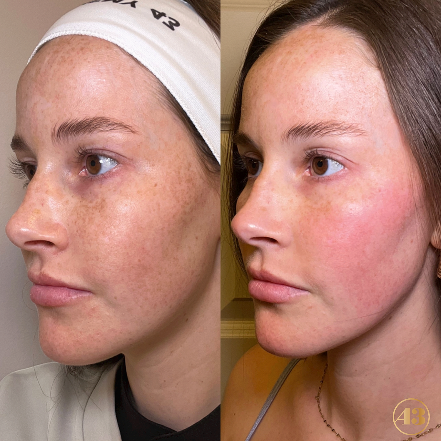 Clear + Brilliant Before & After