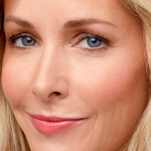 thumb-Glossy-Allergan-refocuses-botox-strategy-on-millennials