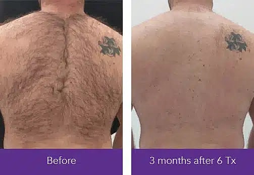  Before & After