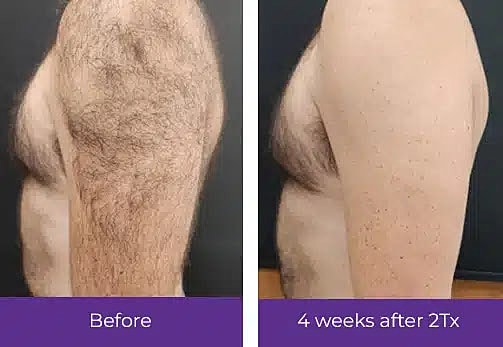  Before & After