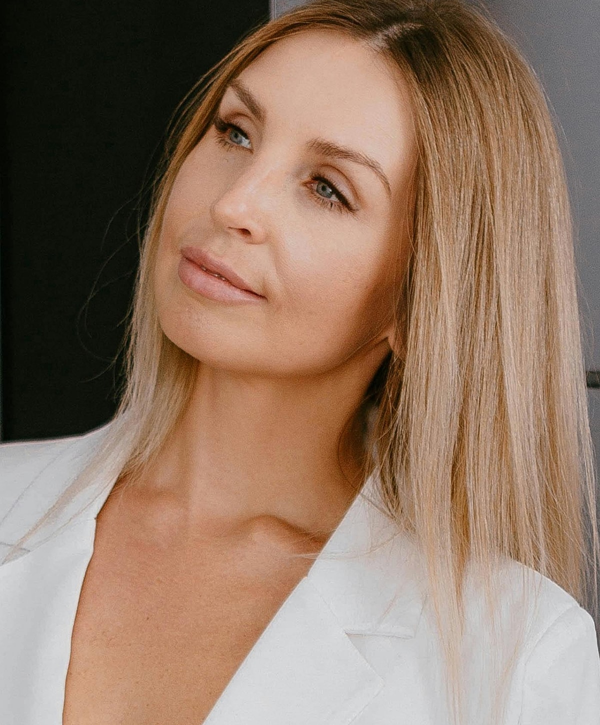 St. Louis Juvederm Ultra model with long blonde hair.