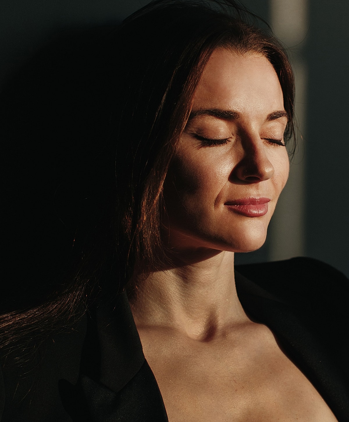 St. Louis CoolPeel model with blonde hair and soft makeup.