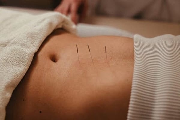 Dr. Natalia Llarena discusses Acupuncture and Endometriosis.