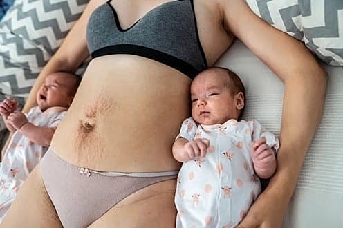 Dr. Wittenberger discusses postpartum body changes.