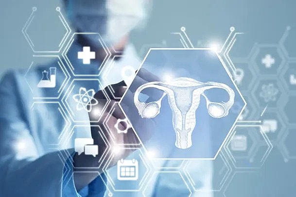 Dr. Coffler in article discussing PCOS