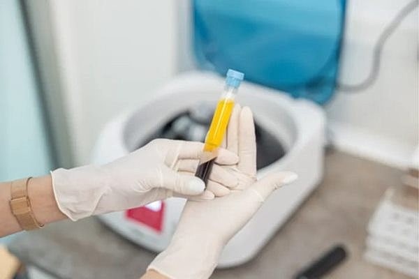 Platelet-rich plasma treatments for IVF patients