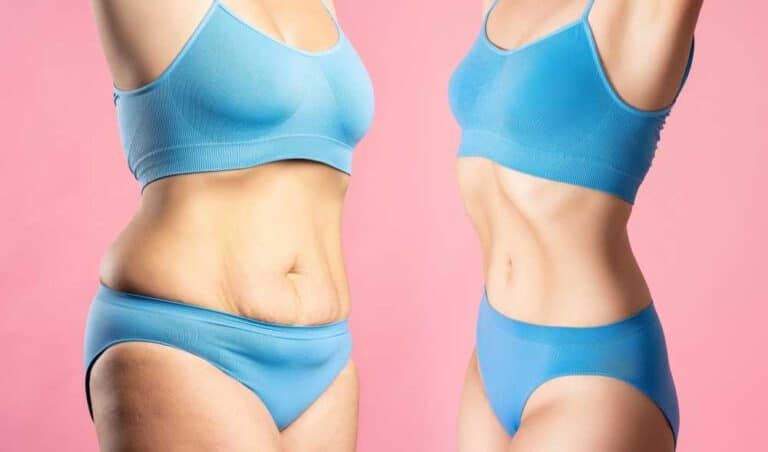 Man or woman, young or old, excess abdominal tissue is...
