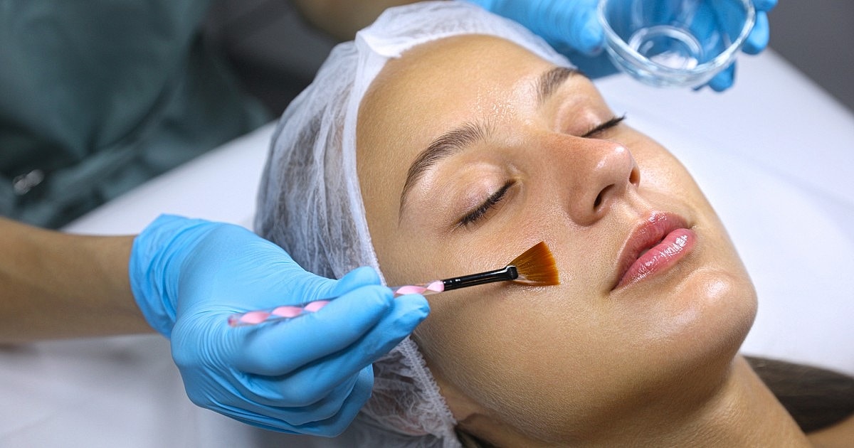 6 Reasons Why Chemical Peels Can Transform Your Skin