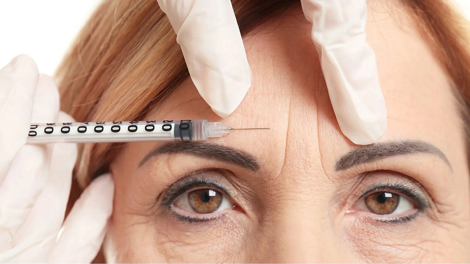 A Quick Guide To Wrinkle Relaxers