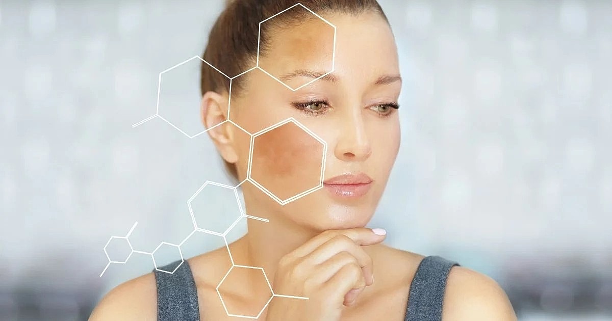Can This Skin Rejuvenation Treatment Help With Hyperpigmentation?