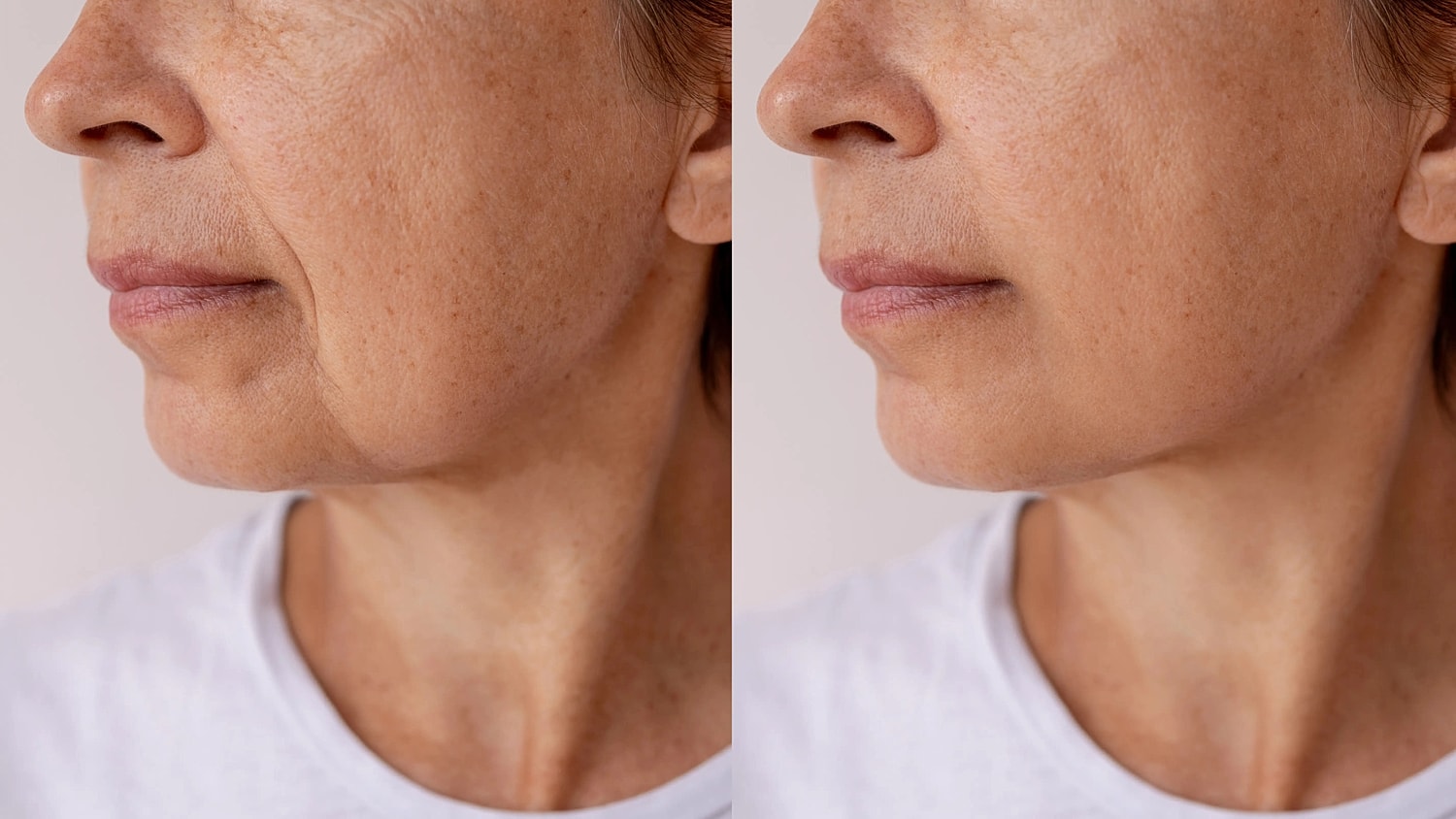 Left and right facial profile images show the same person with visible differences in cheek folds, jawline contour, and skin texture.