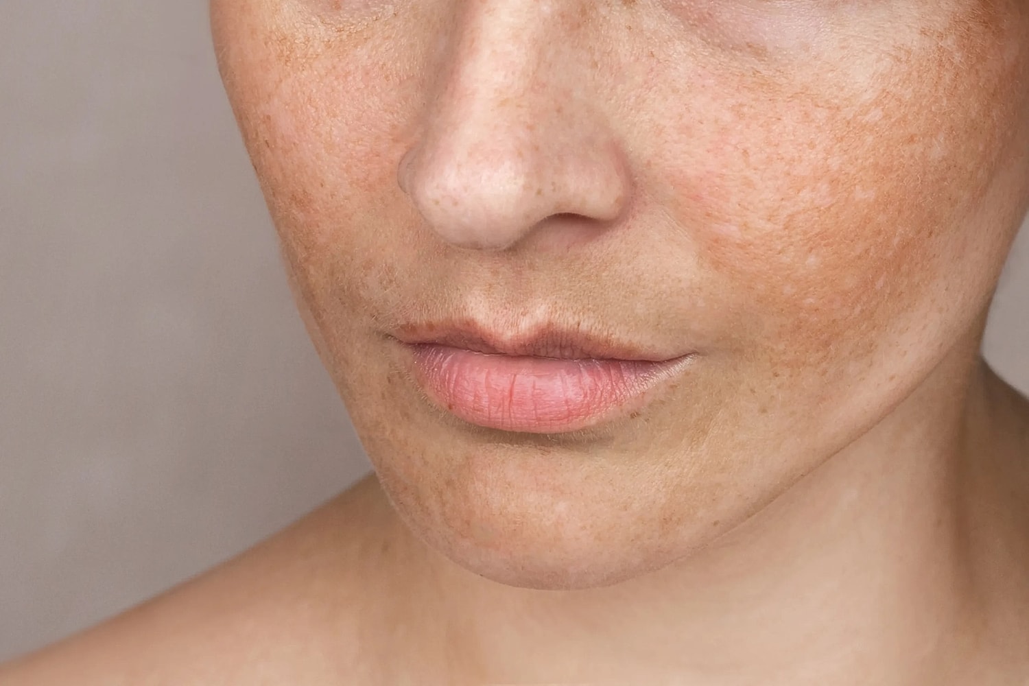 Fall Is the Best Time to Start a Skin Renewal Plan. Here Is Where to Begin