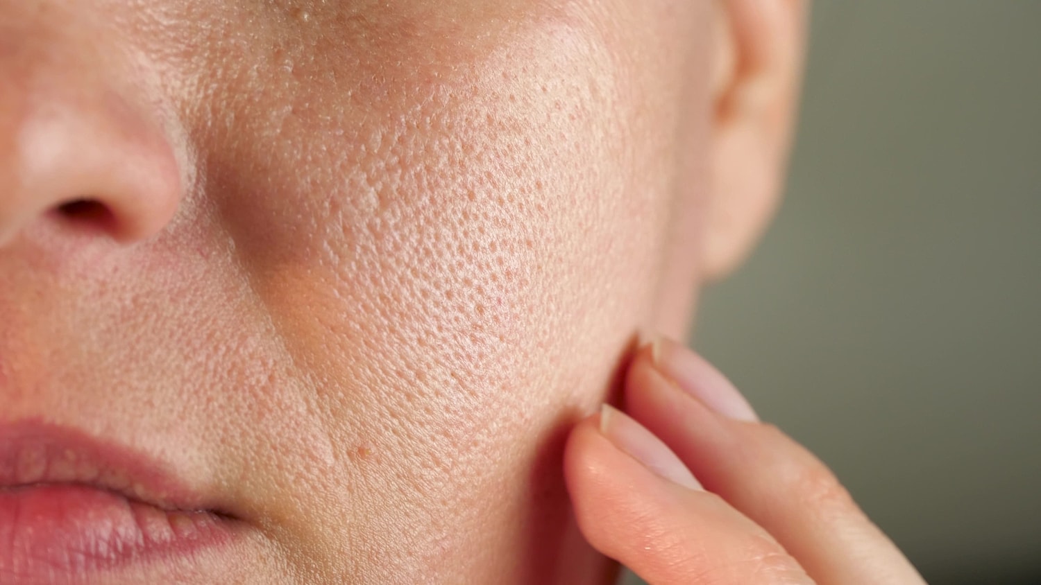 Large Pores & Skin Texture Treatment in Garden City