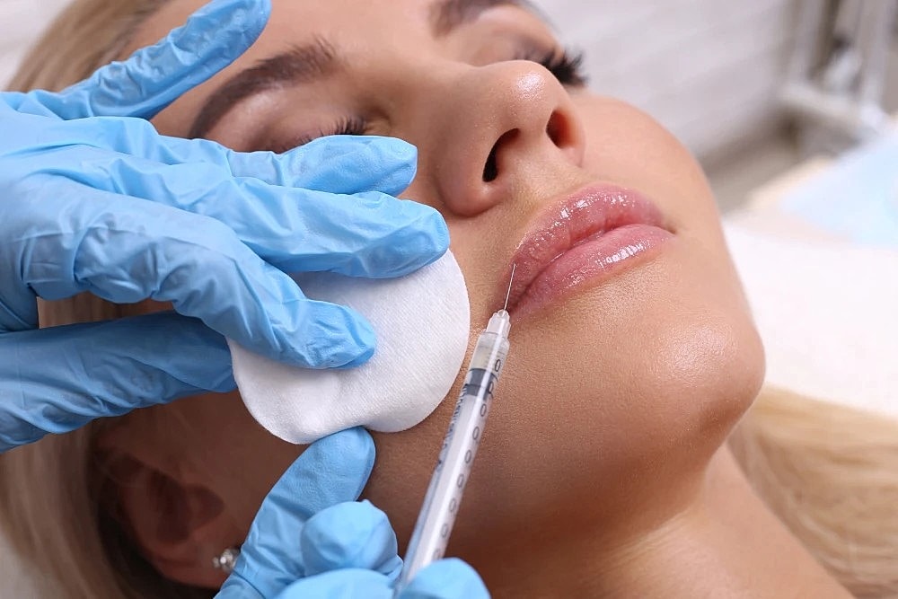 Lip Filler Before & After: What to Expect with Restylane
