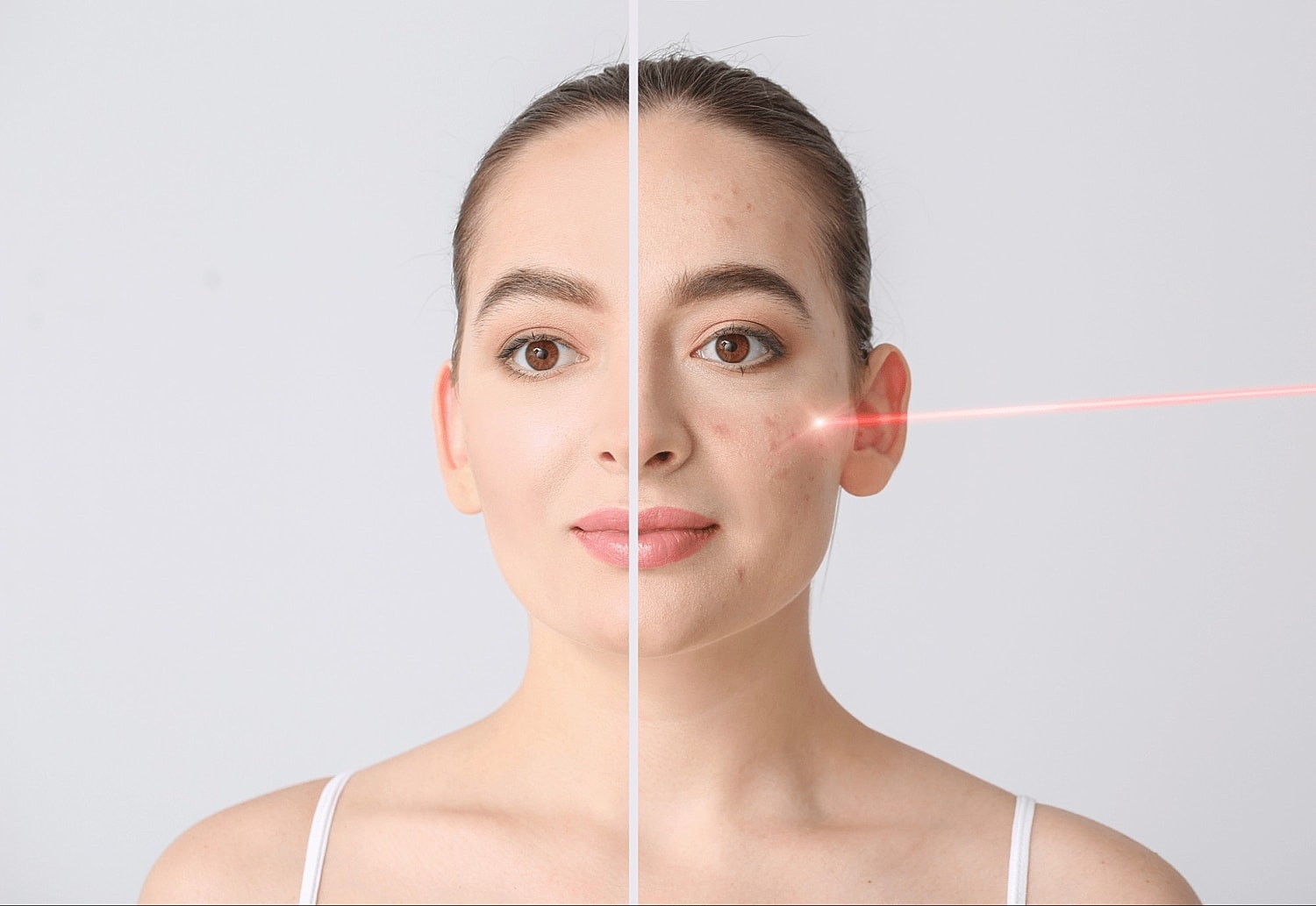 Moxi Aftercare: Essential Tips for Post-Treatment Care and Maintenance - Image 2