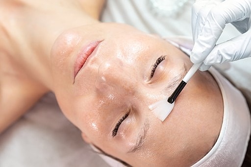 Woman receiving Moxi laser treatment on forehead.