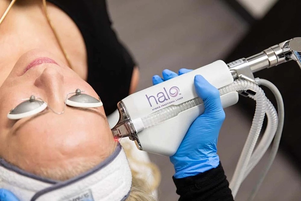 Post-Summer Skin Rescue: How Halo Laser Prepares Your Skin for Fall - Image 2