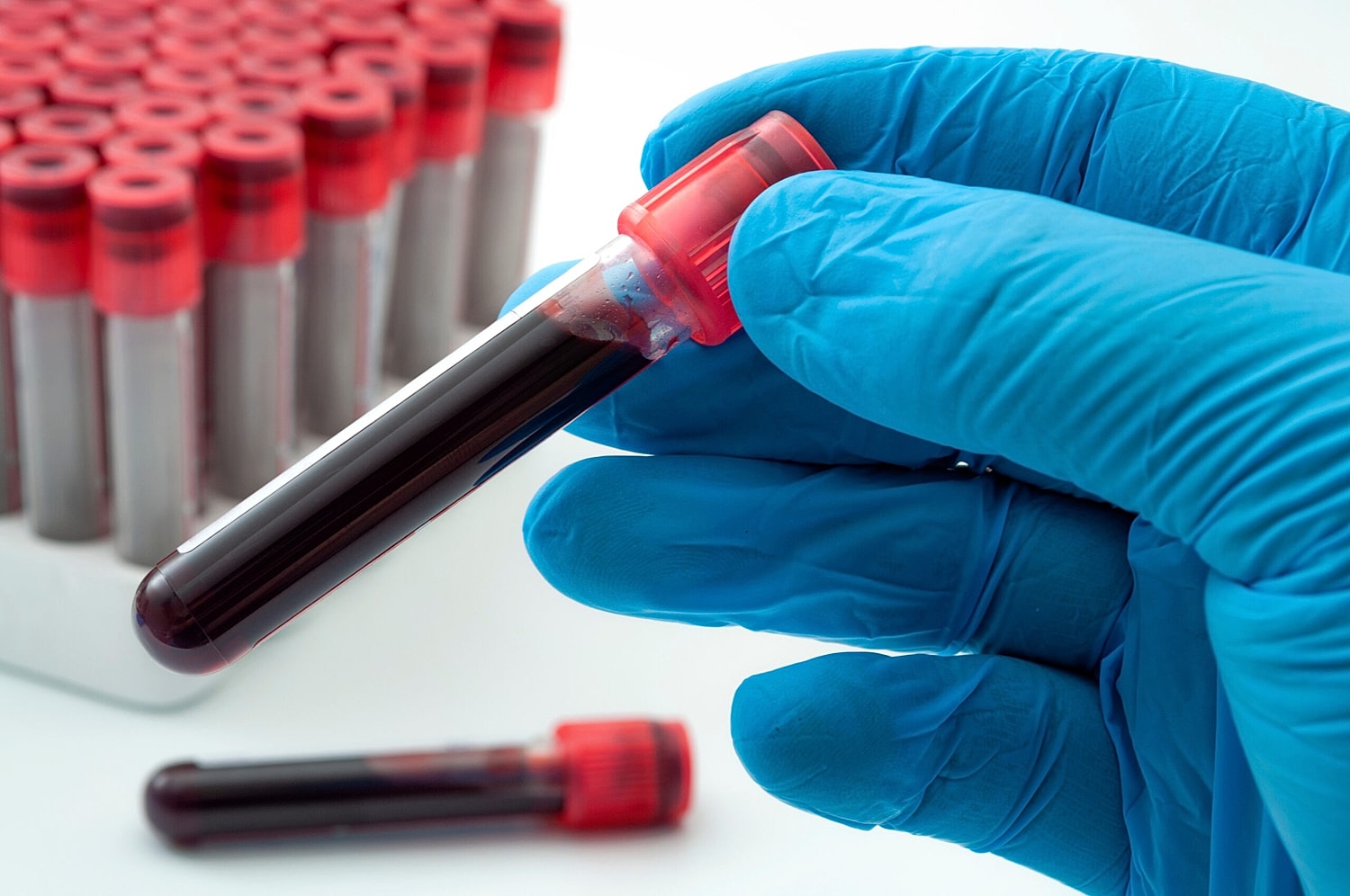 The Major Pluses of PRP Therapy: Can This Treatment Truly Enhance Your Skin?