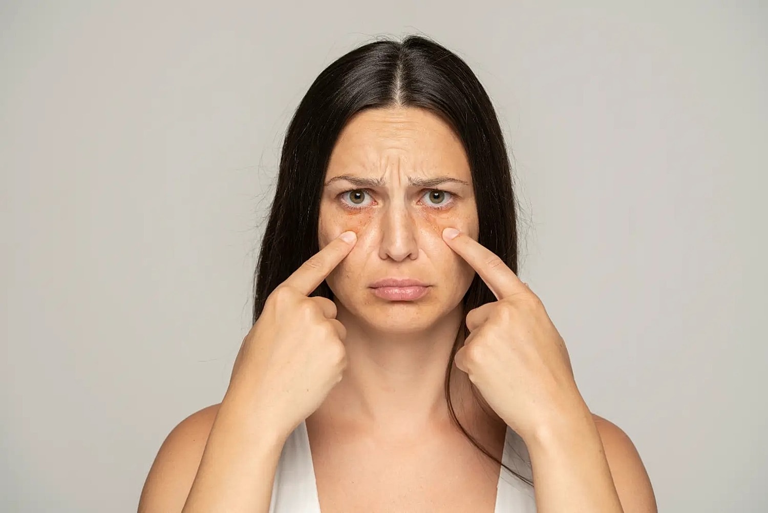 Woman points with both index fingers to visible darkness beneath her eyes against a gray background.