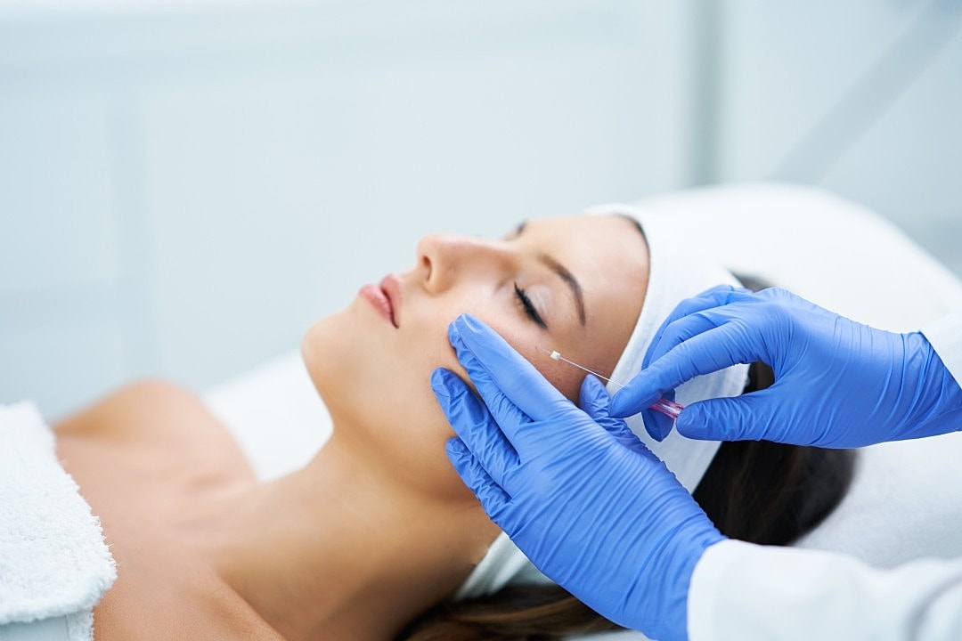 A medical professional performing a PDO Threadlift on a patient.