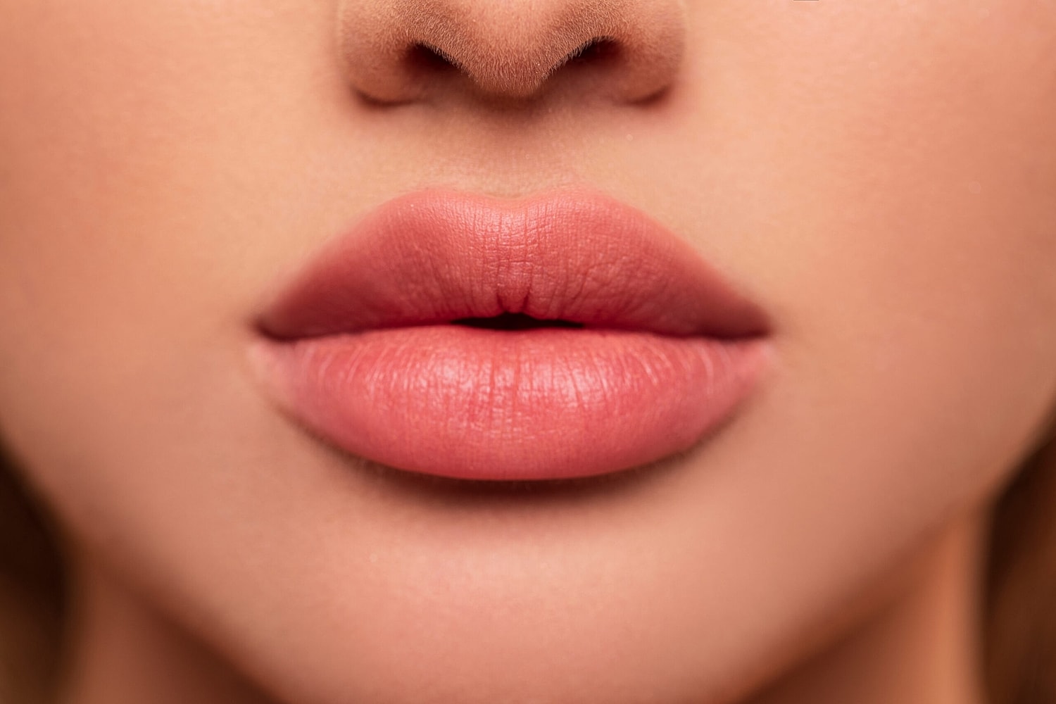 Close-up of plump, smooth lips after a Revanesse Versa treatment.