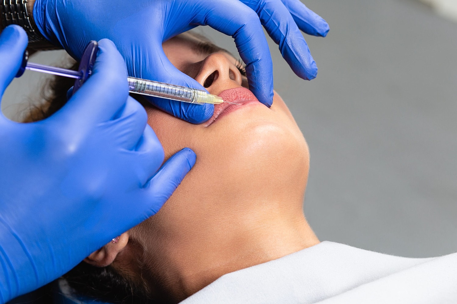 A cosmetic professional injecting Revanesse Versa into a patient's lips for natural volume enhancement.