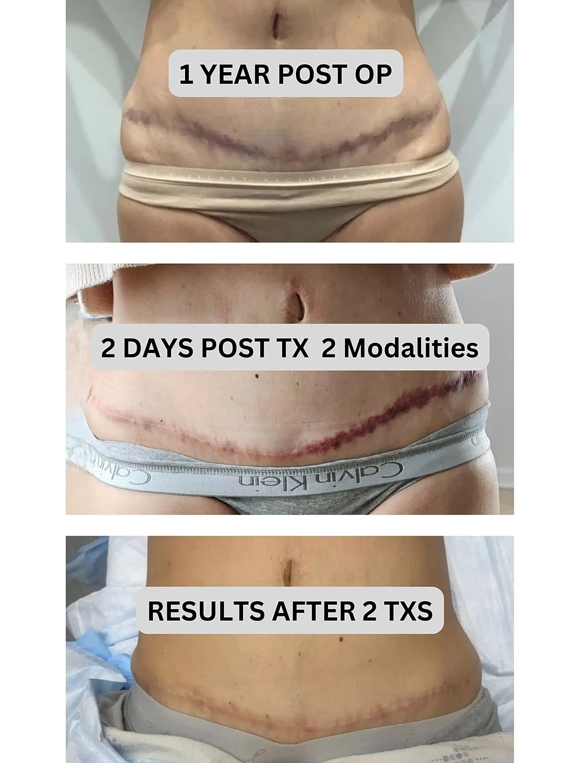 Treating Pigment and Texture 1