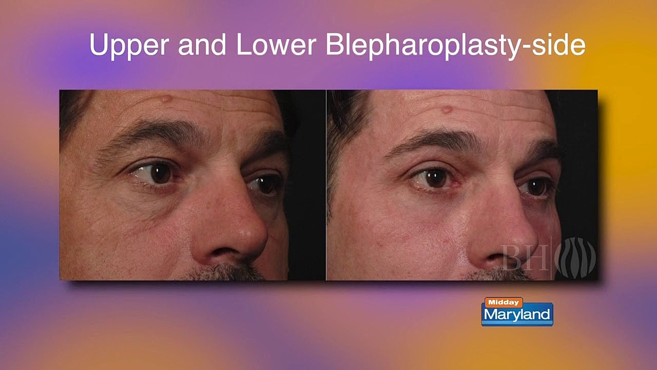 Baltimore Plastic video