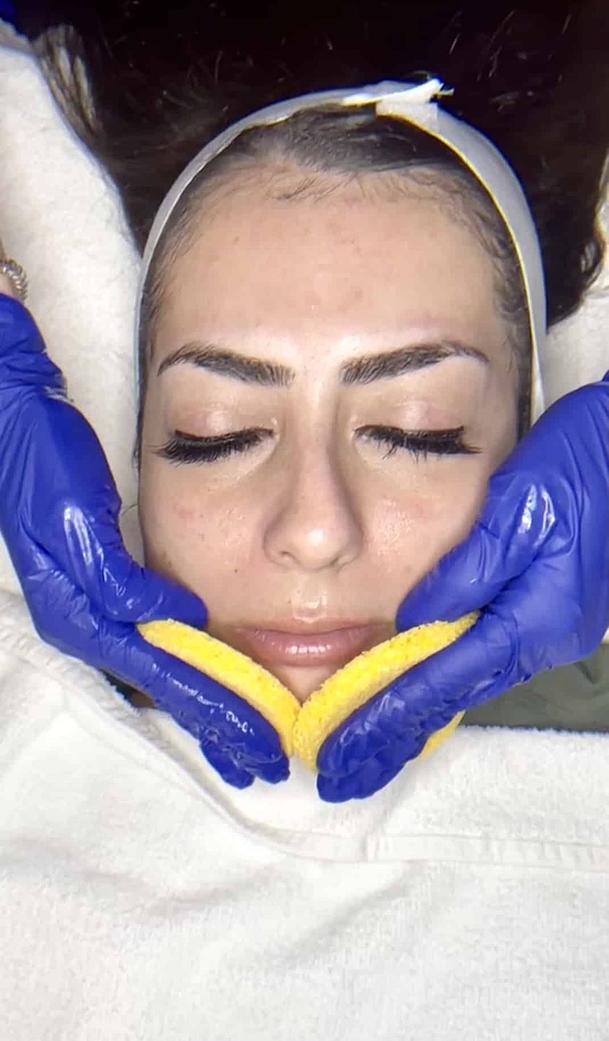 But the Sun Dries Out my Acne...