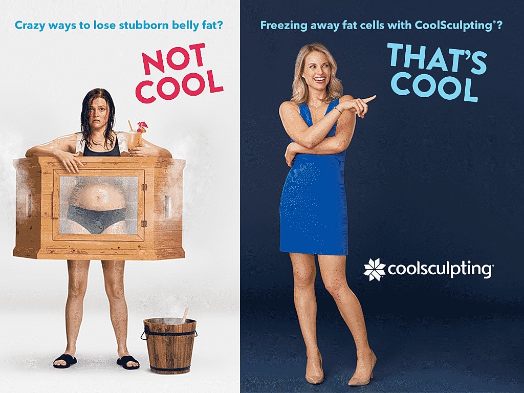 My CoolSculpting Experience