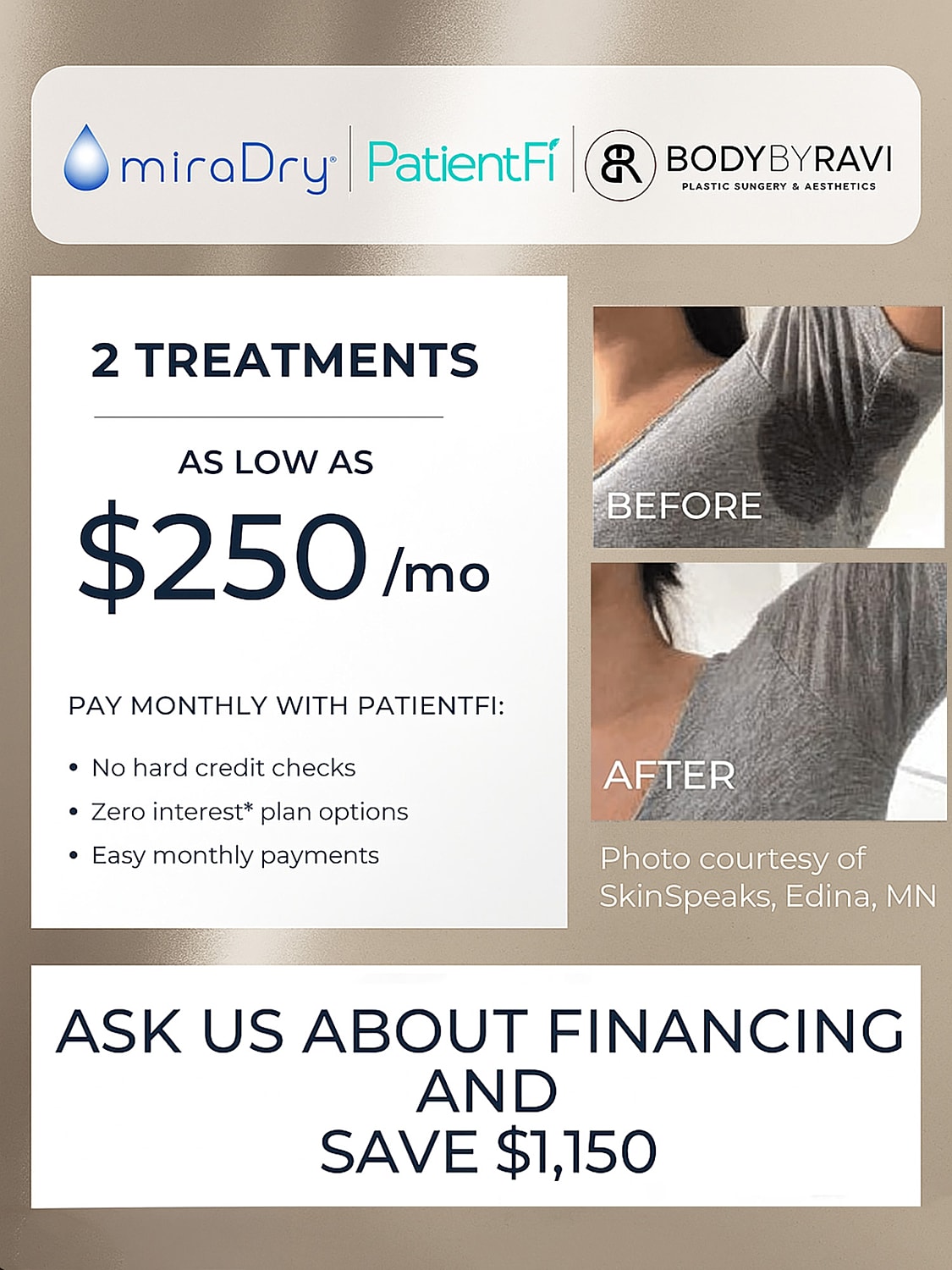 miraDry treatment before and after promotional image